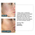 IMARAIS BEAUTY Clarity Anti Acne Skincare Supplement