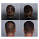 SureThik Hair Thickening Fibers Before and After